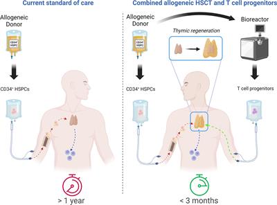 T-Cell Progenitors As A New Immunotherapy to Bypass Hurdles of Allogeneic Hematopoietic Stem Cell Transplantation